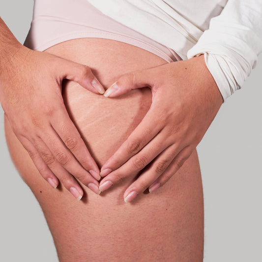 Reducing Cellulite with Acupressure